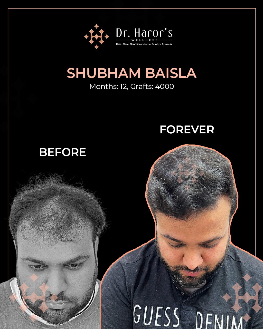 8 - Before and After